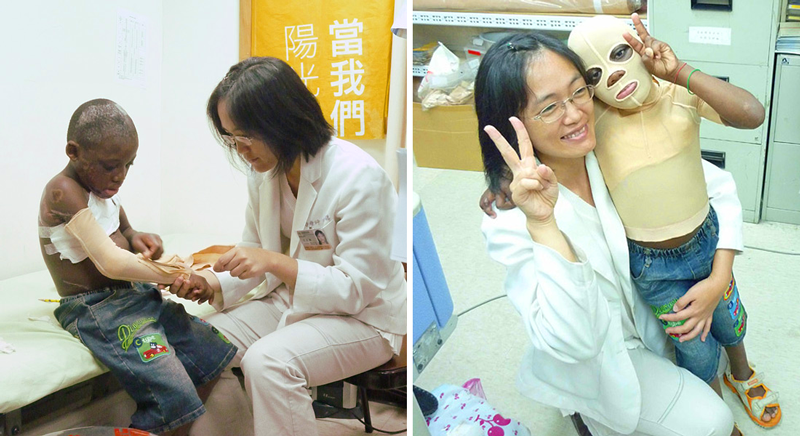 2010年,在外交部和萬芳醫院的努力之下,兩位來自聖多美和普林西比小朋友來臺就醫。陽光治療師協助製作壓力衣,讓他們有更完整的復健。